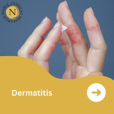 Severe Atopic Dermatitis
